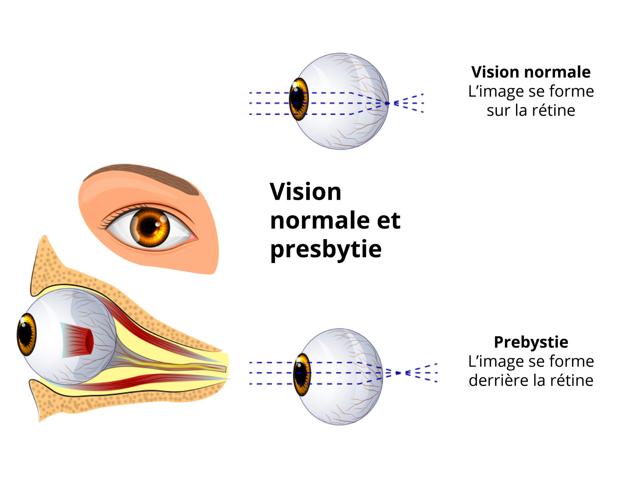 PRESBYTIE-VISIONSUD2